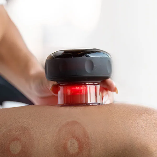 Revomadic Smart Cupping Kit 4-in-1 device for smoother skin